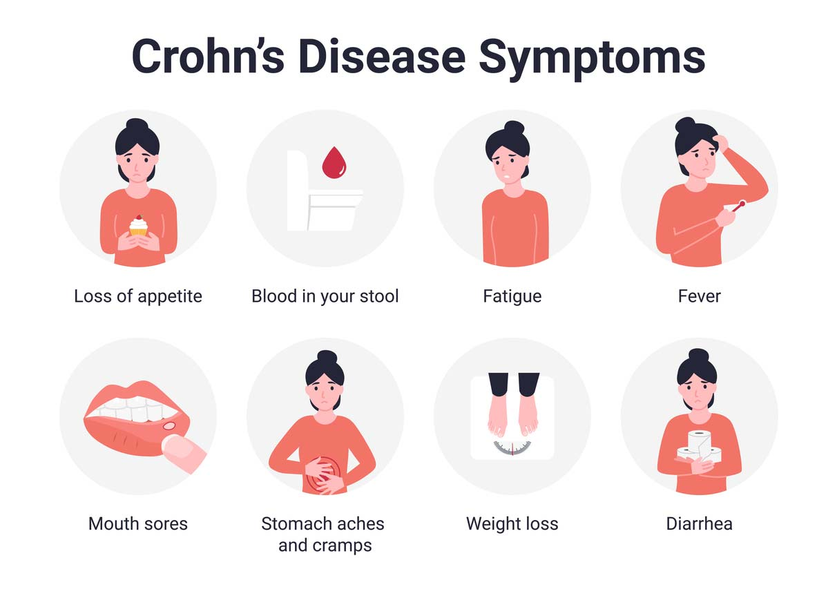 crohn's disease