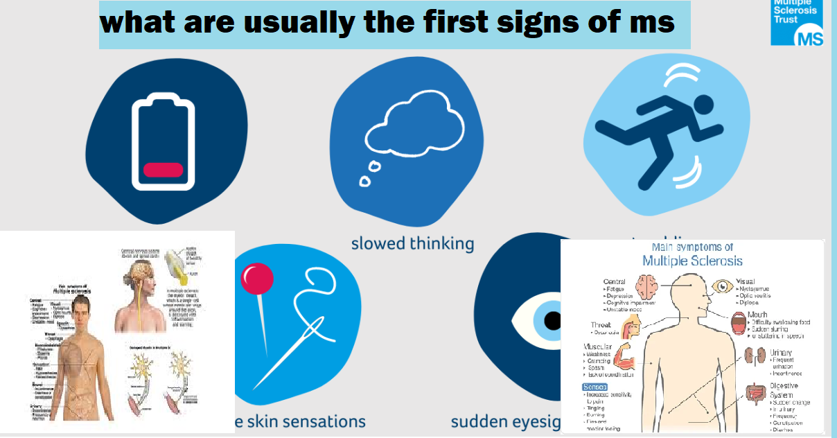 first signs of ms